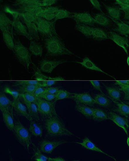 Immunofluorescence analysis of C6 cells using DAPK3 Polyclonal Antibody at dilution of 1:100 (40x lens). Blue: DAPI for nuclear staining.