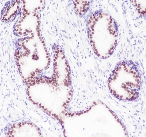 Recombinant FOXA1 Monoclonal Antibody - 2