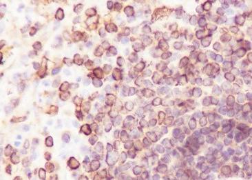 Recombinant CD74 Monoclonal Antibody-searchlist-2