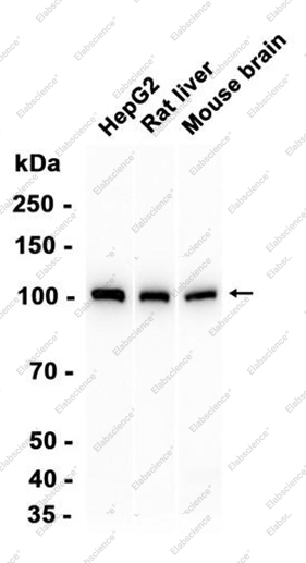 Recombinant alpha Actinin 4 Monoclonal Antibody - 2