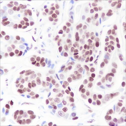 Recombinant SETD1A Monoclonal Antibody-searchlist-1