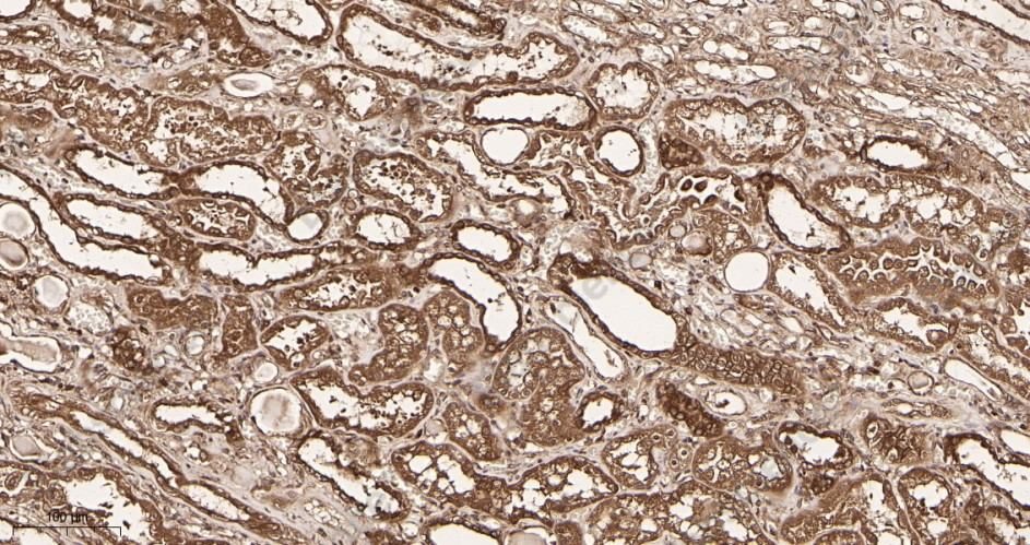 Recombinant Rab 5A Monoclonal Antibody - 2