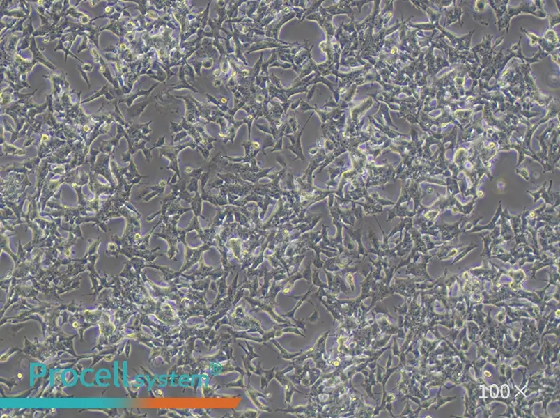 SK-N-BE(2) Cell Complete Medium - 2