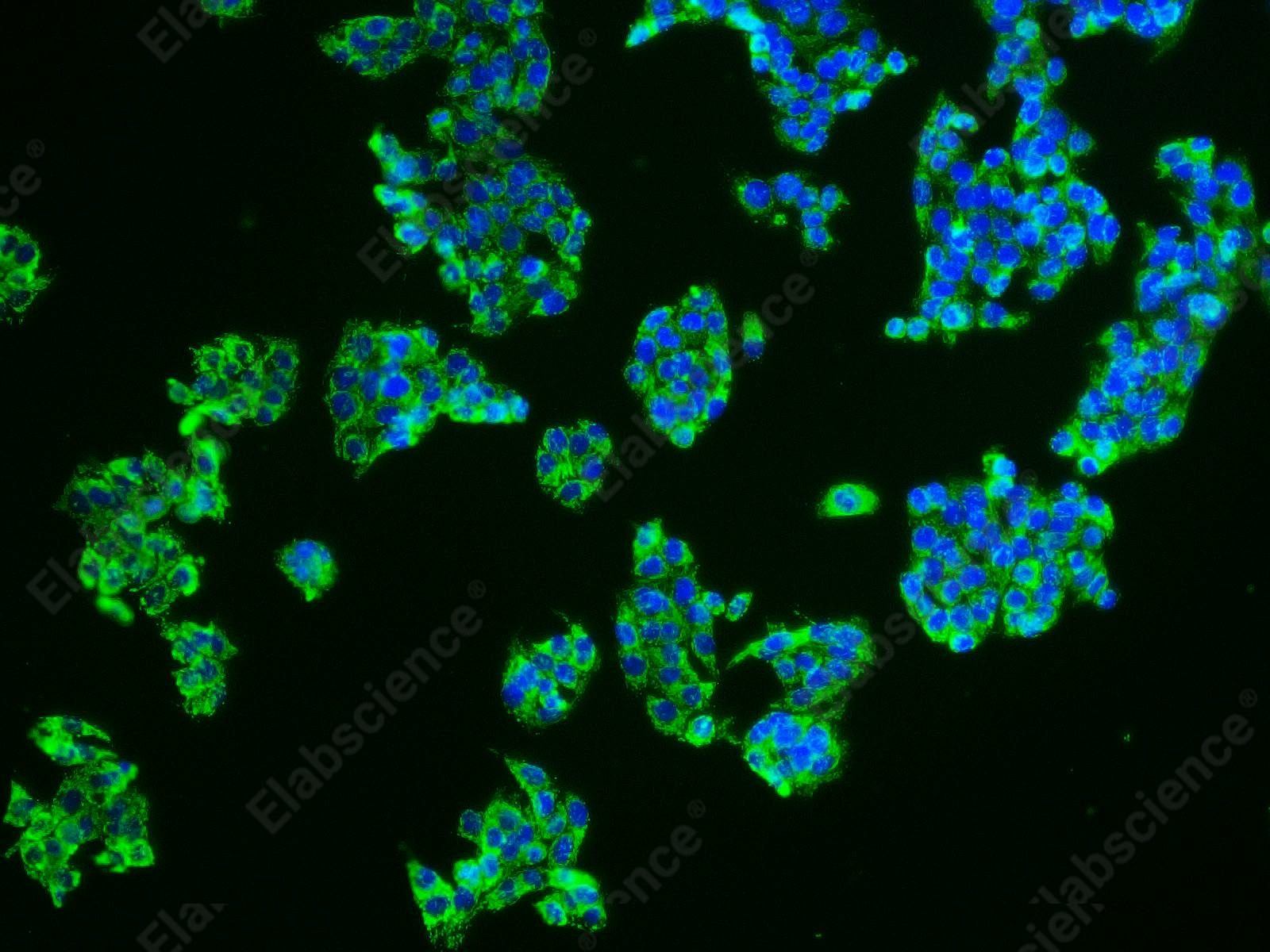 HSP-60 Polyclonal Antibody - 7