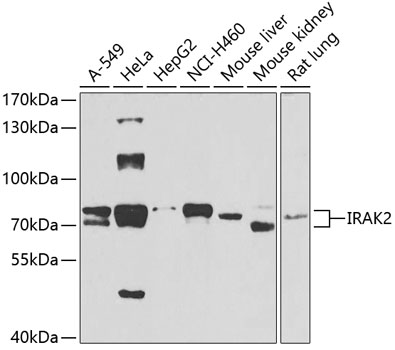 Western blot analysis of extracts of various cell lines using IRAK2 Polyclonal Antibody at 1:1000 dilution.