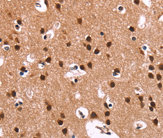 Immunohistochemistry of paraffin-embedded Human brain  using RPSA Polyclonal Antibody at dilution of 1:60