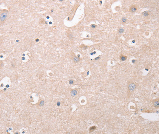 Immunohistochemistry of paraffin-embedded Human brain  tissue using CDCA4 Polyclonal Antibody at dilution 1:50