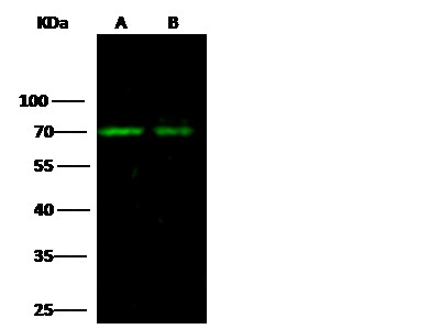 Recombinant Angiopoietin-2/ANG 2 Monoclonal Antibody - small - 2