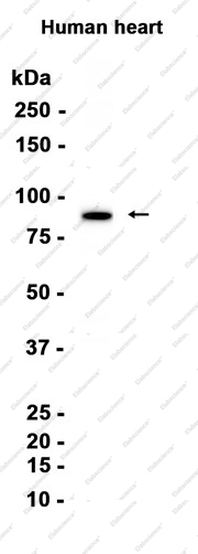 Recombinant CPT1B Monoclonal Antibody - 1