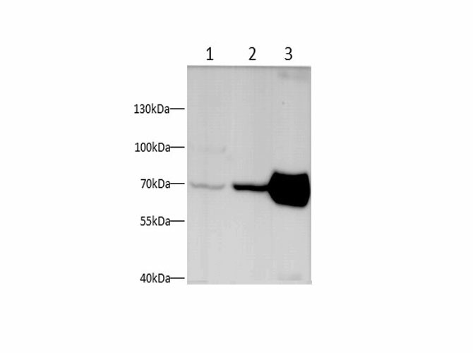 Western blot with NEFL Polyclonal antibody at dilution of 1:500.lane 1:SHSY-5Y whole cell lysate, lane 2:Mouse brain, lane 3:Rat brain