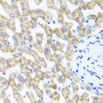 Immunohistochemistry of paraffin-embedded Human liver damage using RIPK4 Polyclonal Antibody at dilution of  1:100 (40x lens).