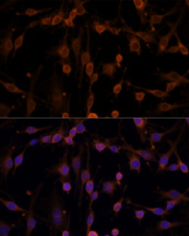 Immunofluorescence analysis of C6 cells using NME1 Polyclonal Antibody at dilution of 1:100. Blue: DAPI for nuclear staining.