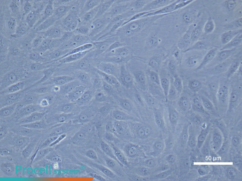 Human Coronary Artery Endothelial Cell Complete Medium - small - 5
