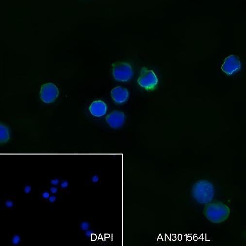 Recombinant IL-12 Monoclonal Antibody-searchlist-1