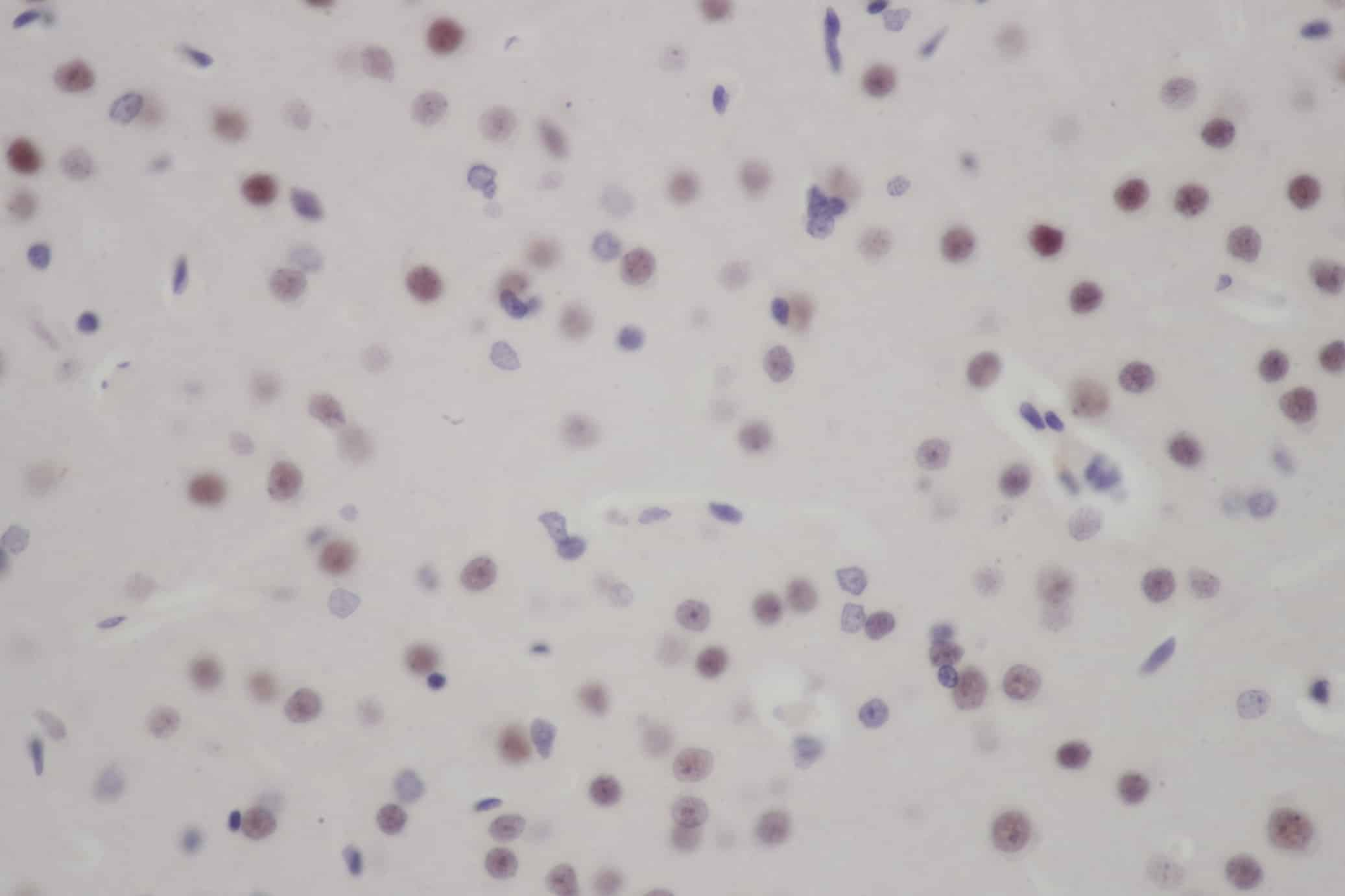 Immunohistochemistry of paraffin-embedded Rat brain using FOXO3 Polyclonal Antibody at dilution of 1:50