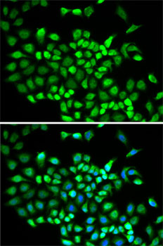 Immunofluorescence analysis of A-549 cells using CUL2 Polyclonal Antibody