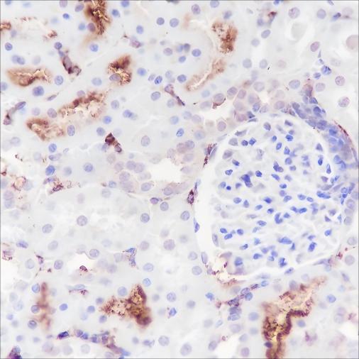 Recombinant DPEP1 Monoclonal Antibody - 3