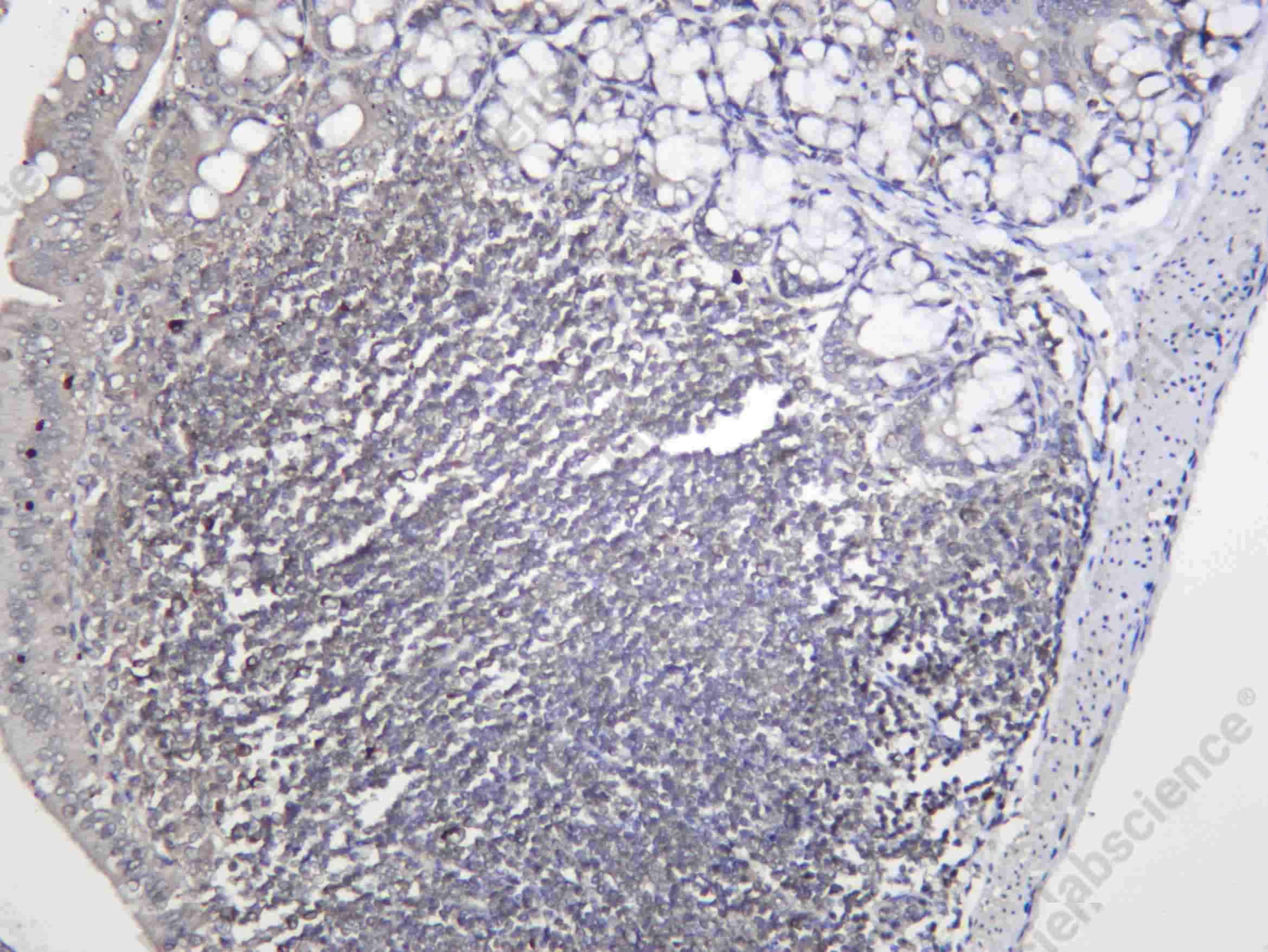 Recombinant STIP1/HOP Monoclonal Antibody - 1