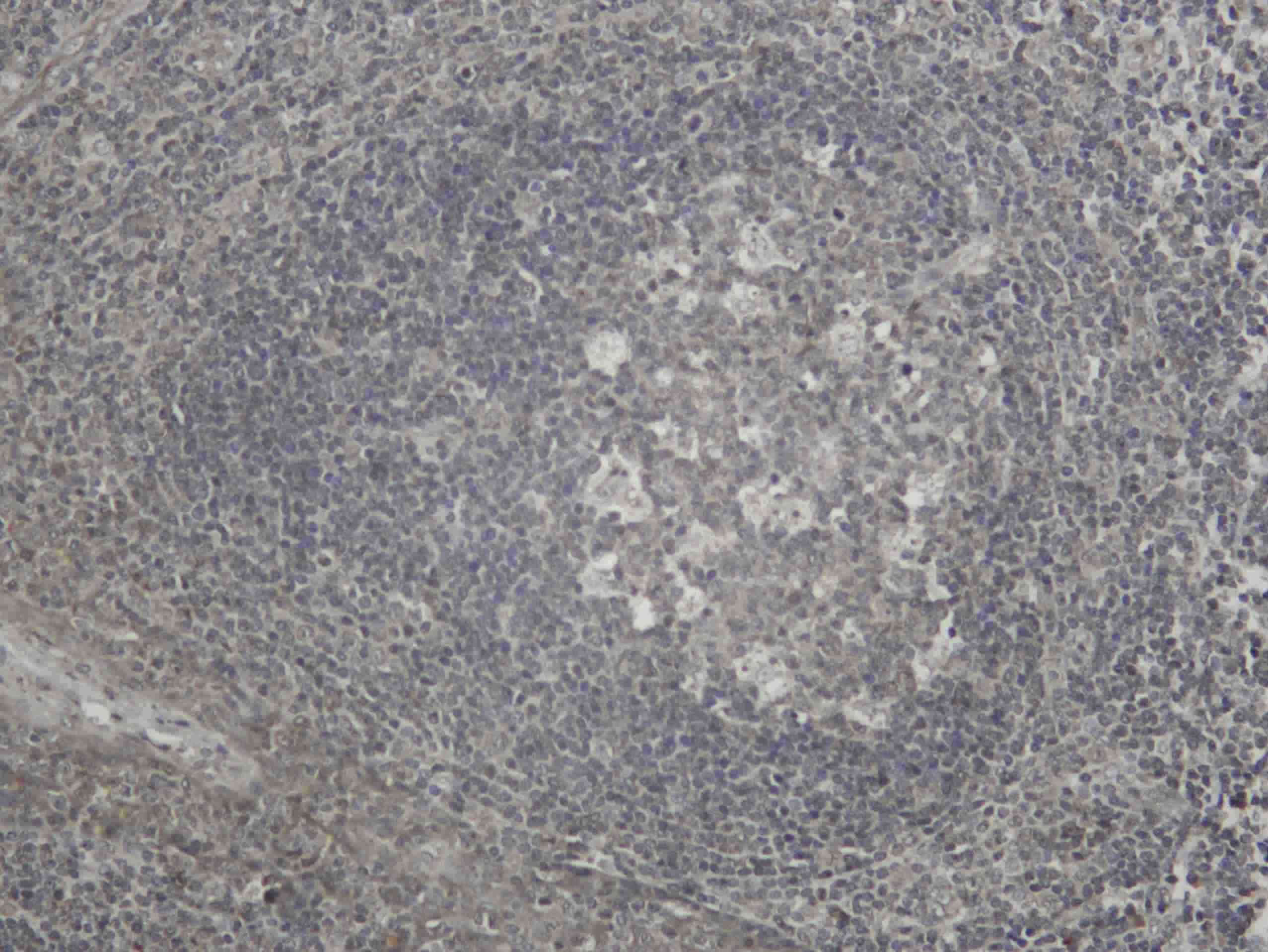 Recombinant Ubiquitin K63 Monoclonal Antibody - 1