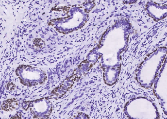Recombinant p63(alpha) Monoclonal Antibody - small - 2