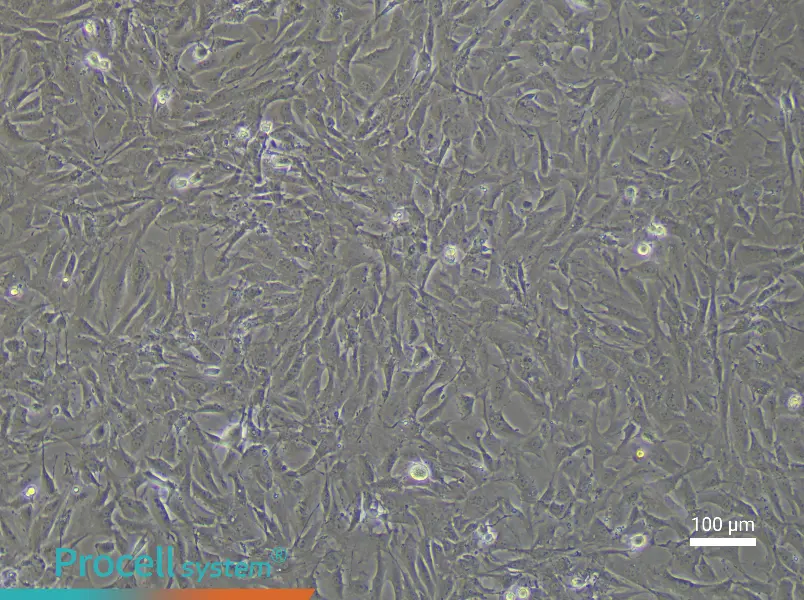 Rat Pulmonary Vascular Smooth Muscle Cell Complete Medium - 2