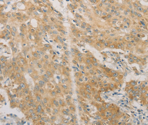 ACSL4 Polyclonal Antibody - 3