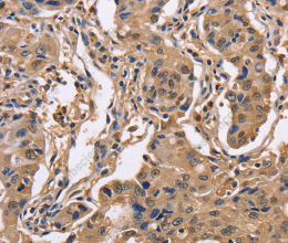 IDH1 Polyclonal Antibody - 3