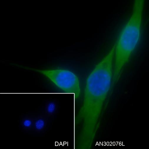 Recombinant Phospho-S6 Ribosomal Protein (Ser235, Ser236) Monoclonal Antibody - small - 5