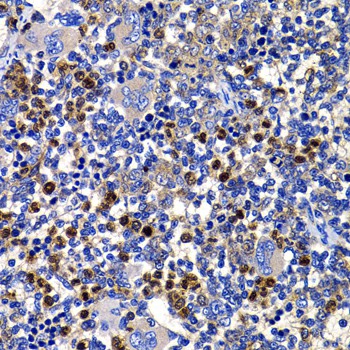 Immunohistochemistry of paraffin-embedded Rat spleen using STAMBP Polyclonal Antibody at dilution of 1:100 (40x lens).