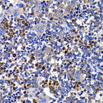 Immunohistochemistry of paraffin-embedded Rat spleen using STAMBP Polyclonal Antibody at dilution of  1:100 (40x lens).