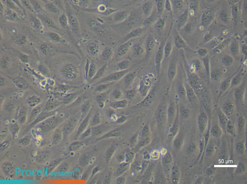 Human Umbilical Vein Endothelial (Primary cell immortalization) Cell Complete Medium - 6