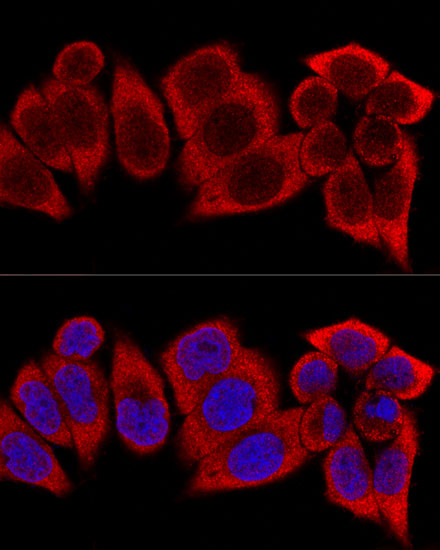 Confocal immunofluorescence analysis of HeLa cells using RPS12 Polyclonal antibody at dilution of 1:400. Blue: DAPI for nuclear staining.