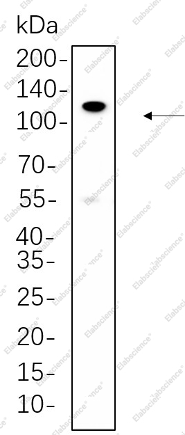 Recombinant PI3-Kinase p110 β Monoclonal Antibody - 1
