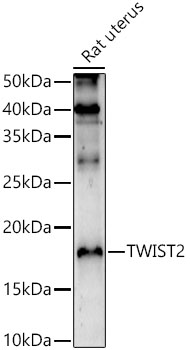 Western blot analysis of extracts of Rat uterus using TWIST2 Polyclonal Antibody at 1:1000 dilution.