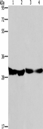 Western Blot analysis of Human endometrial carcinoma and colon cancer tissue, Mouse heart tissue and PC3 cell using DECR1 Polyclonal Antibody at dilution of 1:300