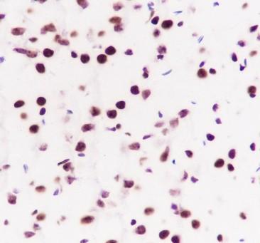 Recombinant RING1B Monoclonal Antibody - small - 3