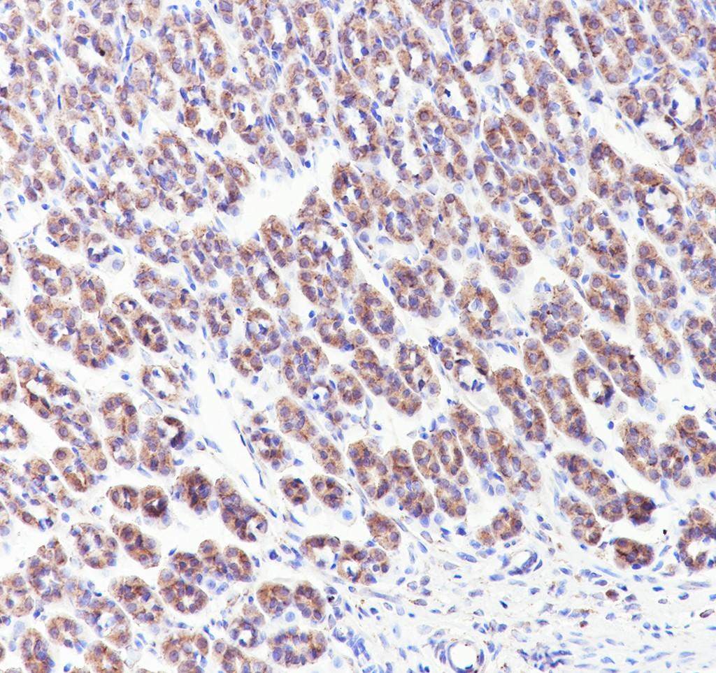 Recombinant GOLGA2/GM130 Monoclonal Antibody - small - 5