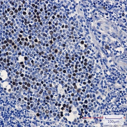 Recombinant KIFC1 Monoclonal Antibody - 2