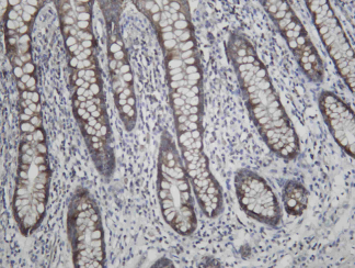 Recombinant LYPLA1 Monoclonal Antibody - 1
