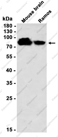 Recombinant Phospho-PKC alpha (Ser657) Monoclonal Antibody - 1