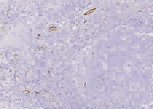 Endoglin/CD105 Monoclonal Antibody - small - 2