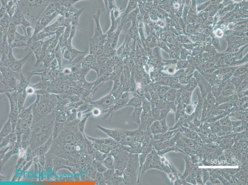 Renca-LUC - 4