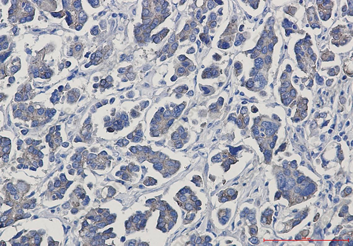 Recombinant gamma Catenin Monoclonal Antibody - 4
