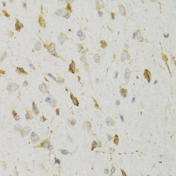 Immunohistochemistry of paraffin-embedded Rat brain using KISS1R Polyclonal Antibody at dilution of  1:100 (40x lens).