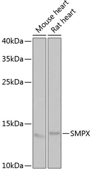 Western blot analysis of extracts of various cell lines using SMPX Polyclonal Antibody at 1:1000 dilution.