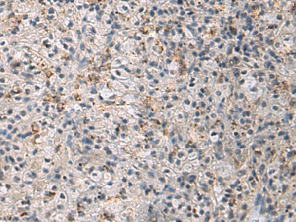 Immunohistochemistry of paraffin-embedded Human brain tissue  using IRS4 Polyclonal Antibody at dilution of 1:45(?200)