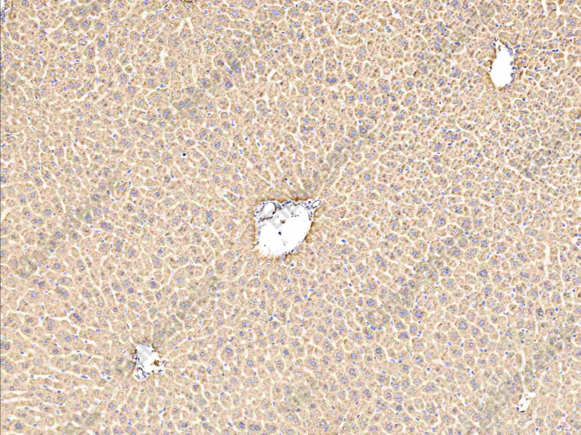 Recombinant ALDH7A1 Monoclonal Antibody - 2