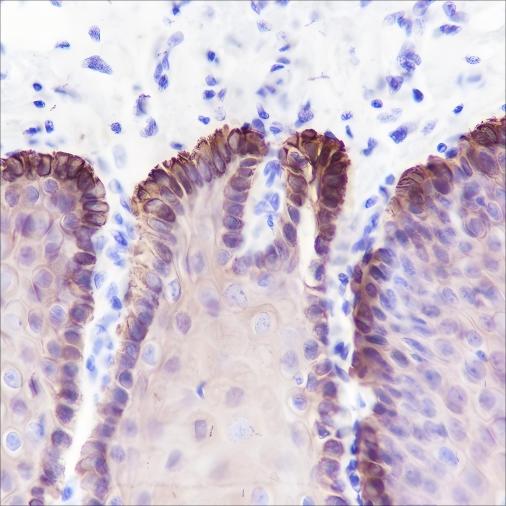Recombinant Keratin 16 Monoclonal Antibody - 2