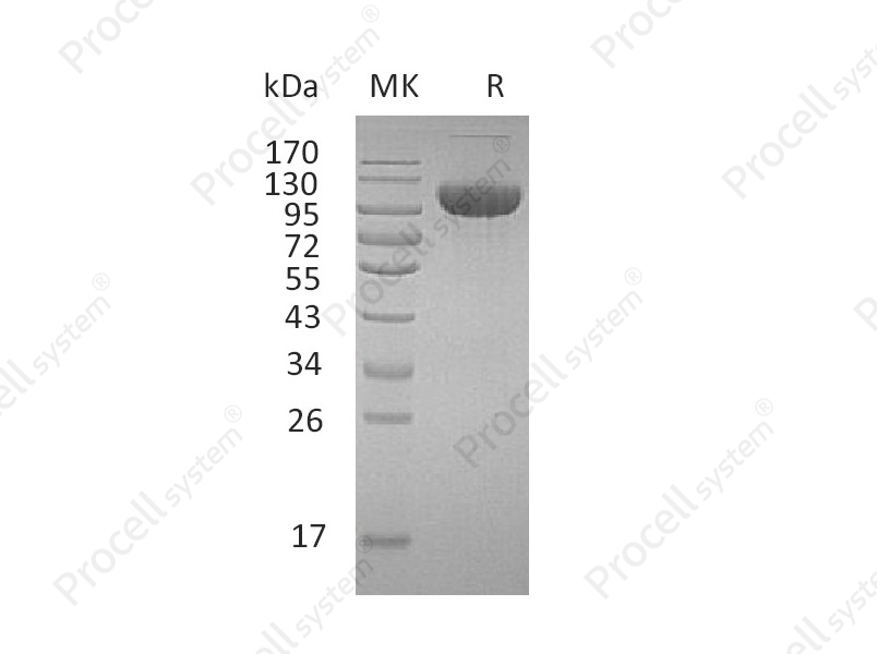 FGFR-3/CD333/FGFR3 (C-Fc), Human, Recombinant