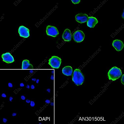 Recombinant Cystatin A Monoclonal Antibody - 2